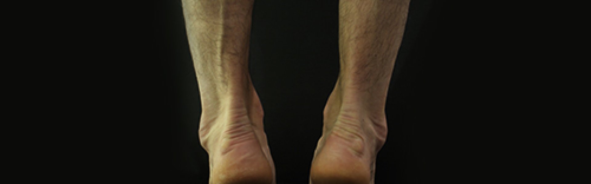 london orthopaedist foot and ankle treatments