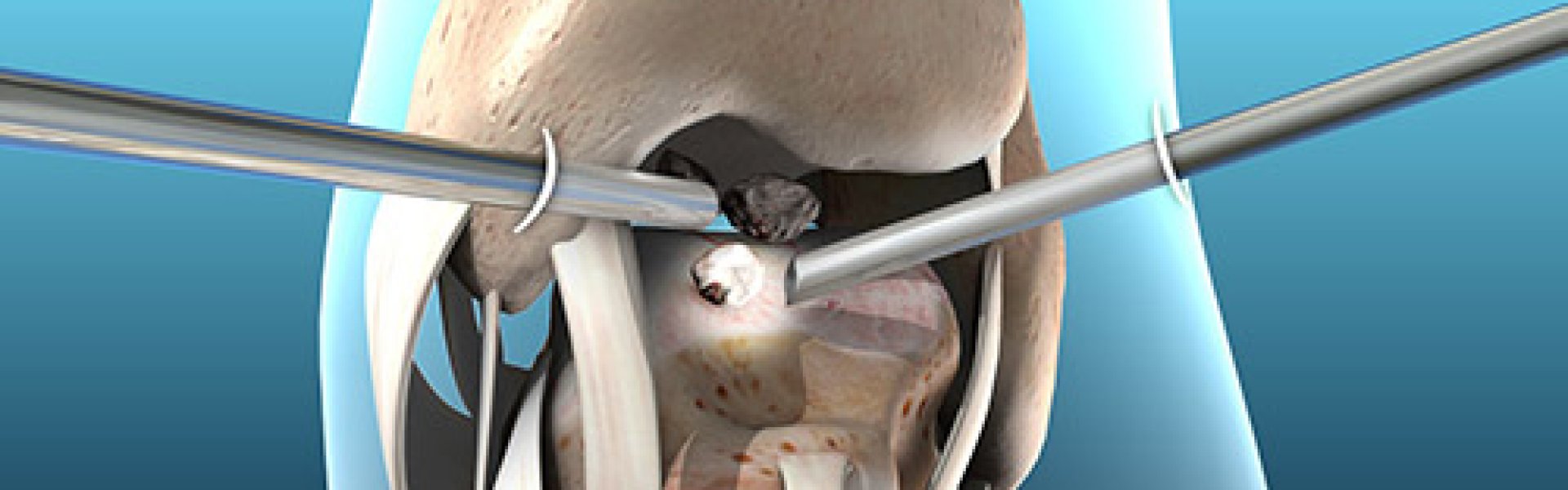 london orthopaedist foot and ankle treatments