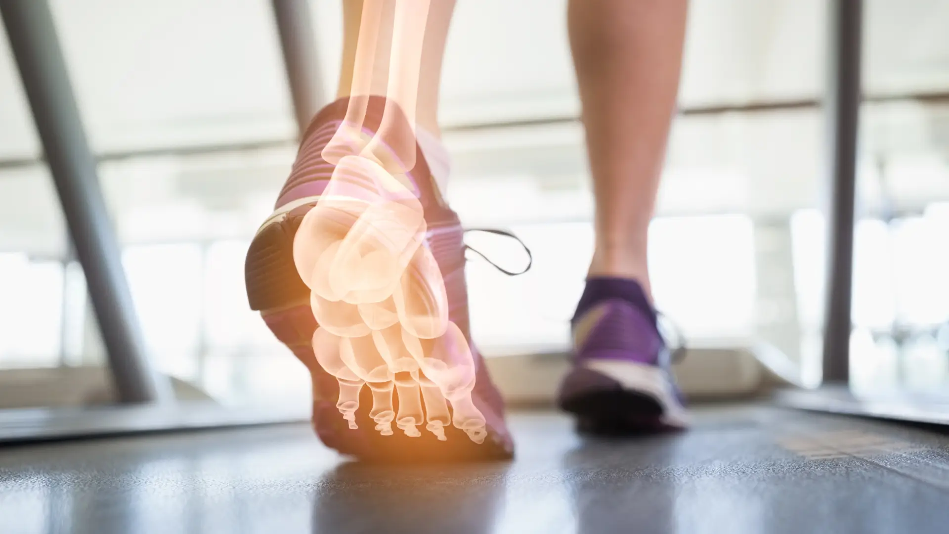 Ankle anatomy showing the structures that can produce a click during walking